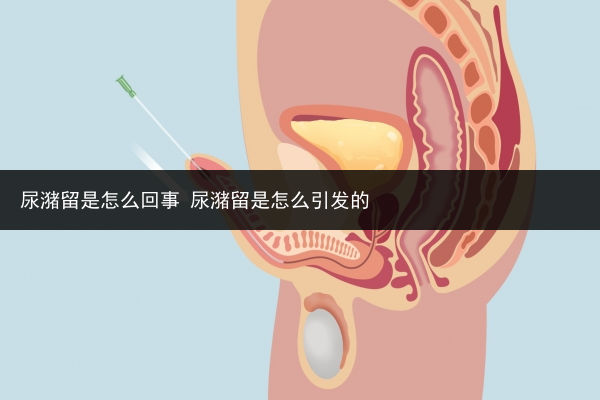 尿潴留是怎么回事 尿潴留是怎么引發的