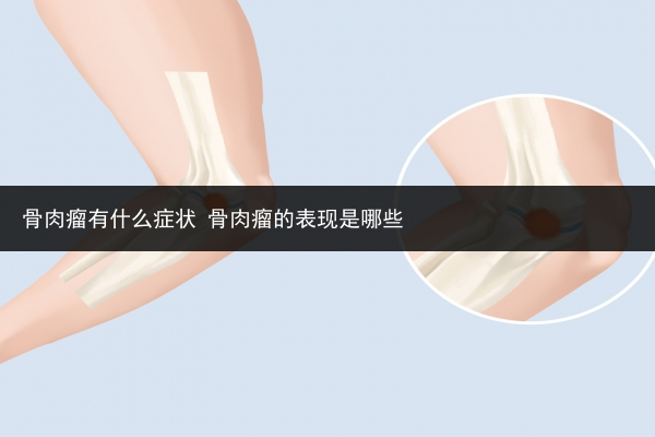 骨肉瘤有什么癥狀 骨肉瘤的表現是哪些