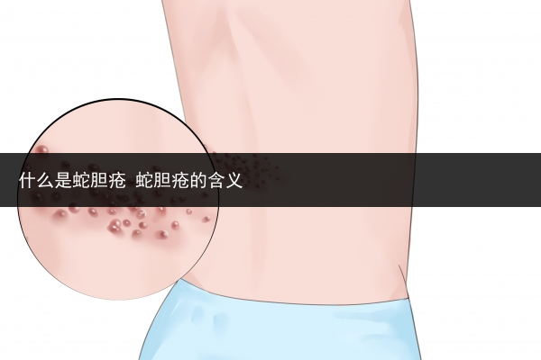 什么是蛇膽瘡 蛇膽瘡的含義