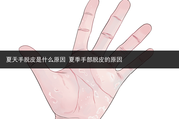 夏天手脫皮是什么原因 夏季手部脫皮的原因