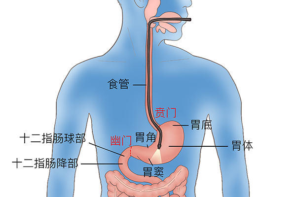 賁門(mén)癌是什么意思，賁門(mén)癌該怎么治療