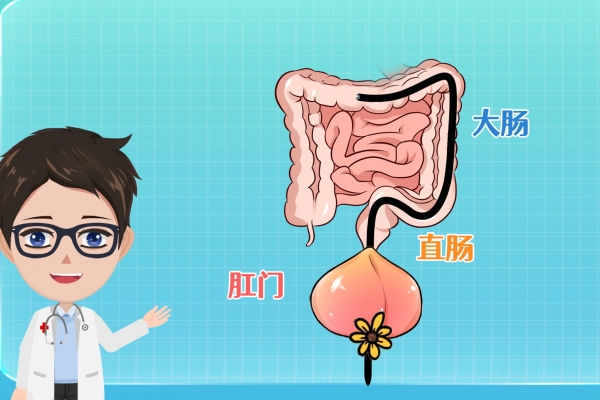 什么是直腸炎 直腸炎是什么意思