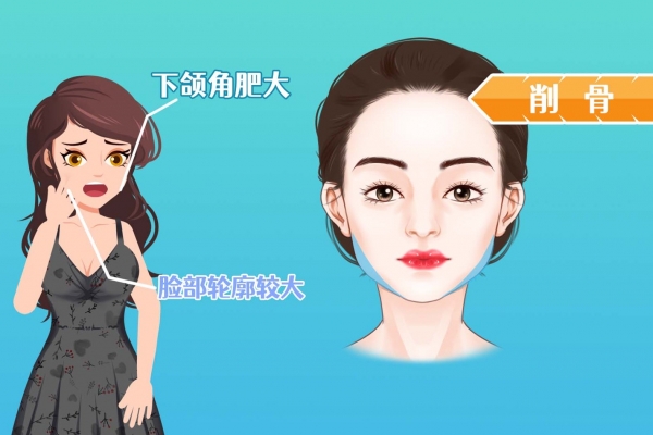 ?深圳醫(yī)美整形醫(yī)院排行榜 深圳醫(yī)美整形醫(yī)院排名