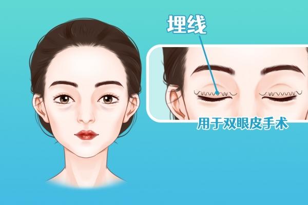 ?割雙眼皮哪個醫(yī)院比較好 割雙眼皮比較好的醫(yī)院有哪些