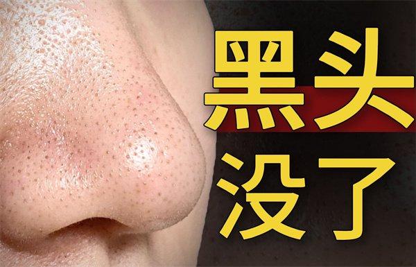去黑頭產(chǎn)品哪個牌子好？去黑頭還不會大毛孔的護膚品排行榜